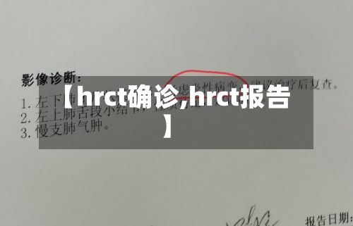 【hrct确诊,hrct报告】-第2张图片