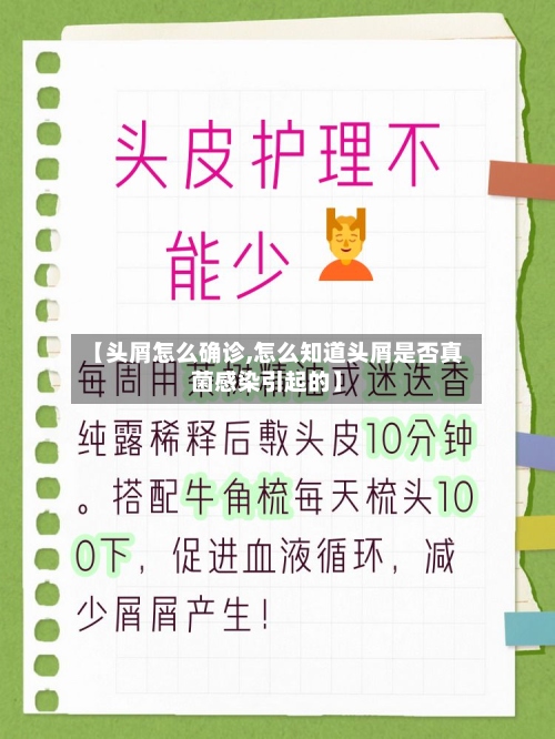 【头屑怎么确诊,怎么知道头屑是否真菌感染引起的】