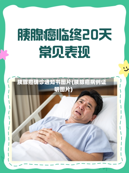 胰腺癌确诊通知书图片(胰腺癌病例证明图片)