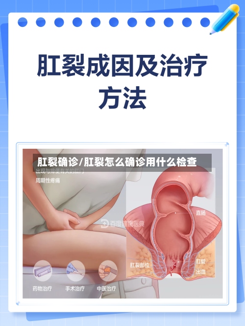 肛裂确诊/肛裂怎么确诊用什么检查
