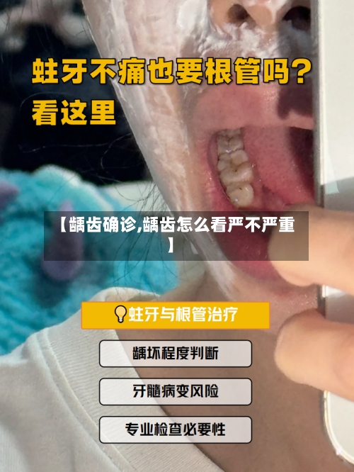 【龋齿确诊,龋齿怎么看严不严重】-第3张图片