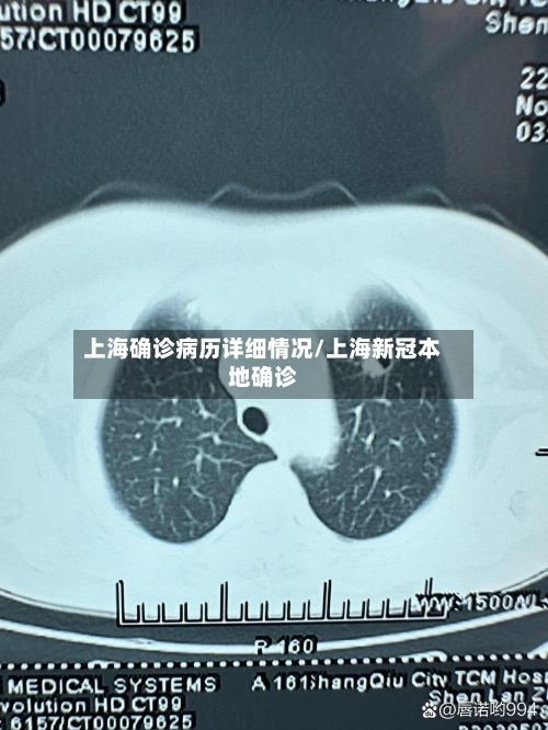 上海确诊病历详细情况/上海新冠本地确诊-第2张图片