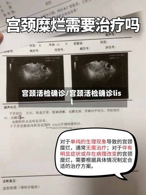 宫颈活检确诊/宫颈活检确诊lisl-第2张图片