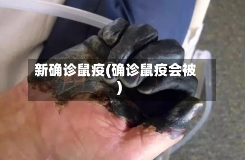 新确诊鼠疫(确诊鼠疫会被)-第3张图片
