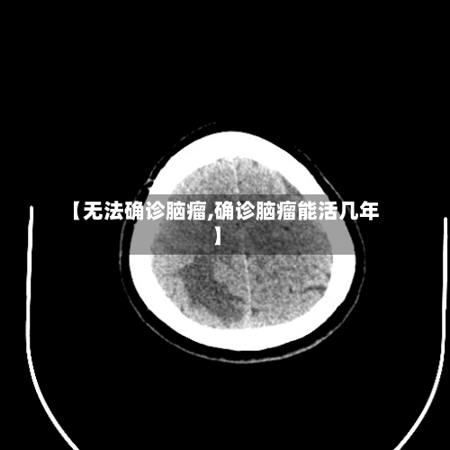 【无法确诊脑瘤,确诊脑瘤能活几年】-第2张图片