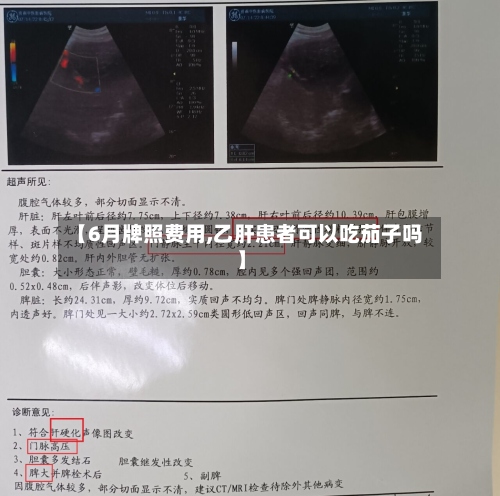 【6月牌照费用,乙肝患者可以吃茄子吗】-第3张图片