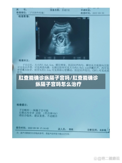 肛查能确诊纵隔子宫吗/肛查能确诊纵隔子宫吗怎么治疗